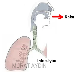 Nefes kokusu