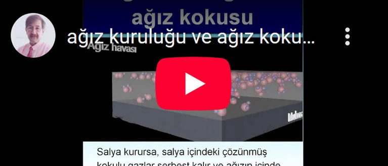 ağız kuruluğu - murat aydın